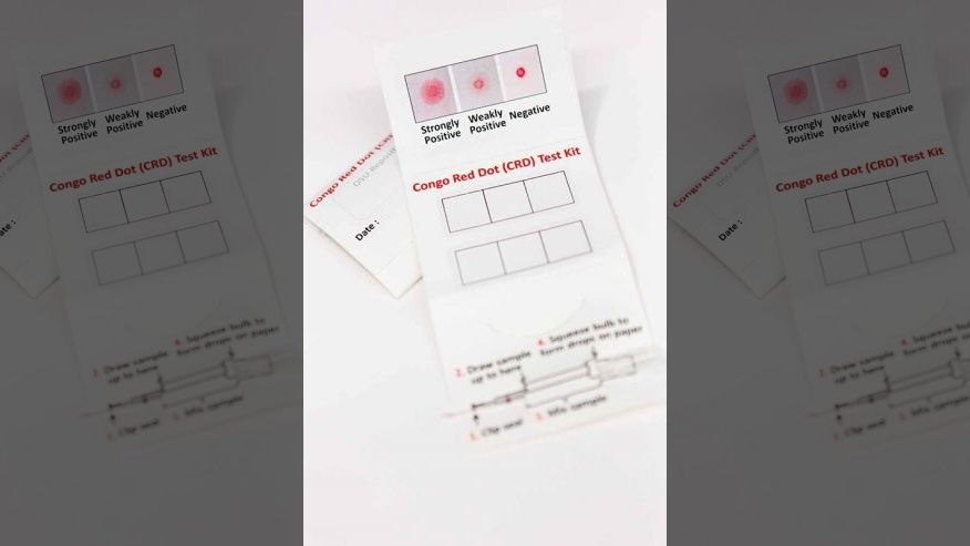 Simple test offers quick diagnosis of potentially deadly prenatal condition